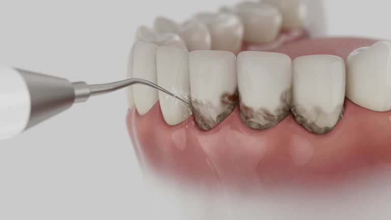 Reliable Dental Implants contractor in Jonesboro, AR by Smile Center Dentistry
